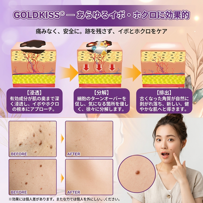 日本製・国内発送✨ 𝐆𝐎𝐋𝐃𝐊𝐈𝐒𝐒® 𝐆𝐇𝐊-𝐂𝐮 & 𝐁𝐈𝐎𝐓𝐈𝐍 𝟏𝟎-𝐈𝐍-𝟏「ゴールドキッス ® GHK-Cu ＆ ビオチン 10-in-1」スキンリストアクリーム⚡贅沢な美容成分が 1 つに凝縮！！