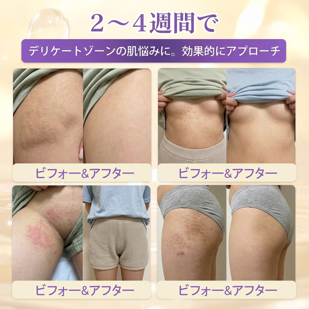 日本製・国内発送✨ 𝐆𝐎𝐋𝐃𝐊𝐈𝐒𝐒® 𝐆𝐇𝐊-𝐂𝐮 & 𝐁𝐈𝐎𝐓𝐈𝐍 𝟏𝟎-𝐈𝐍-𝟏「ゴールドキッス ® GHK-Cu ＆ ビオチン 10-in-1」スキンリストアクリーム⚡贅沢な美容成分が 1 つに凝縮！！