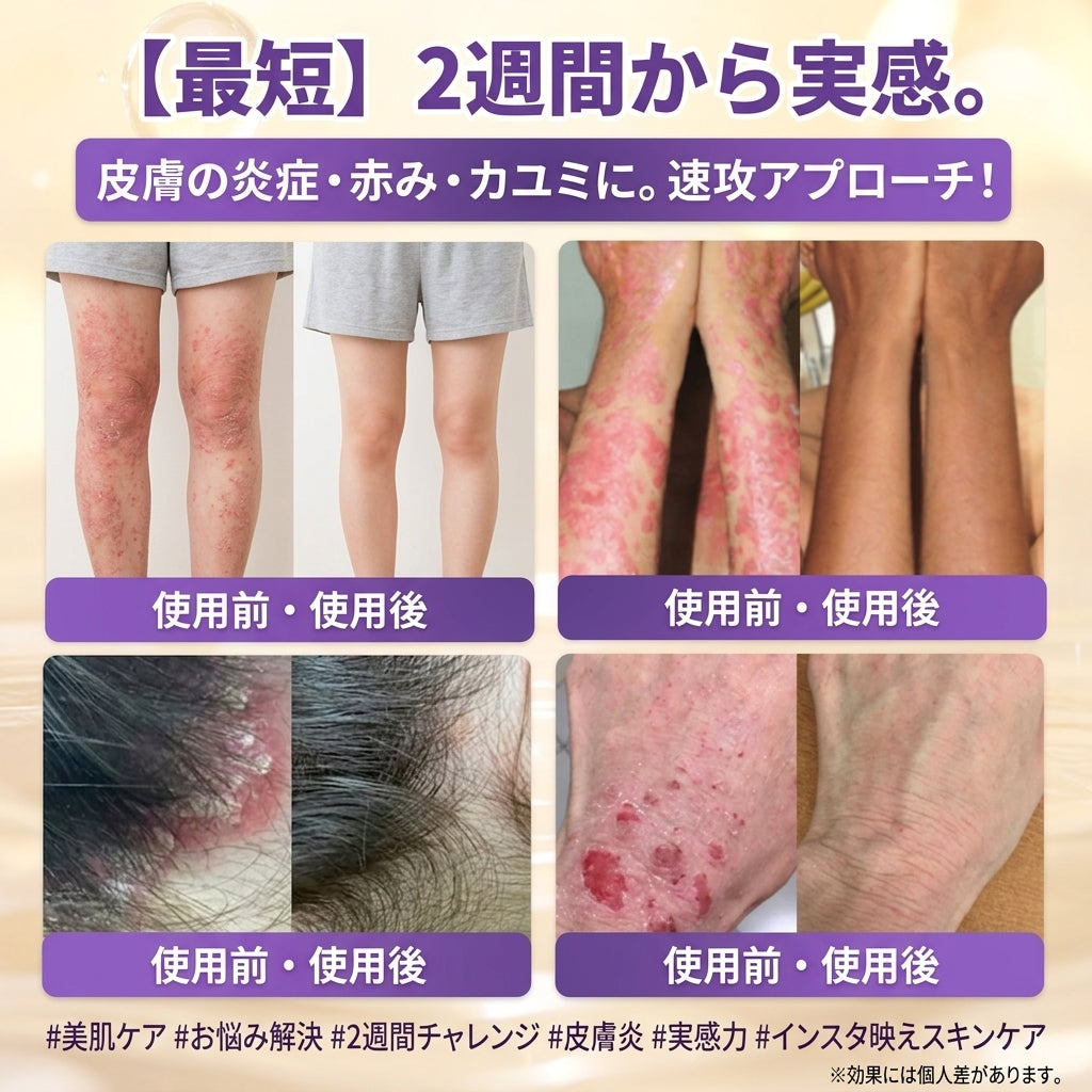 日本製・国内発送✨ 𝐆𝐎𝐋𝐃𝐊𝐈𝐒𝐒® 𝐆𝐇𝐊-𝐂𝐮 & 𝐁𝐈𝐎𝐓𝐈𝐍 𝟏𝟎-𝐈𝐍-𝟏「ゴールドキッス ® GHK-Cu ＆ ビオチン 10-in-1」スキンリストアクリーム⚡贅沢な美容成分が 1 つに凝縮！！