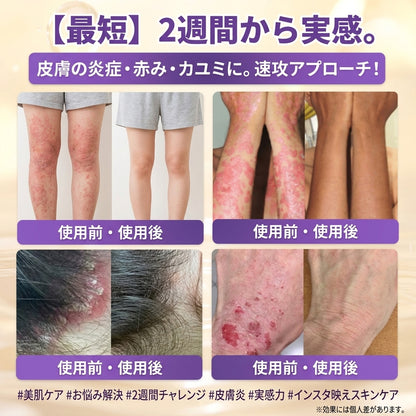 日本製・国内発送✨ 𝐆𝐎𝐋𝐃𝐊𝐈𝐒𝐒® 𝐆𝐇𝐊-𝐂𝐮 & 𝐁𝐈𝐎𝐓𝐈𝐍 𝟏𝟎-𝐈𝐍-𝟏「ゴールドキッス ® GHK-Cu ＆ ビオチン 10-in-1」スキンリストアクリーム⚡贅沢な美容成分が 1 つに凝縮！！