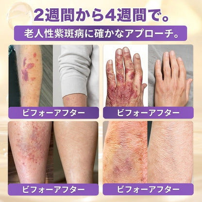 日本製・国内発送✨ 𝐆𝐎𝐋𝐃𝐊𝐈𝐒𝐒® 𝐆𝐇𝐊-𝐂𝐮 & 𝐁𝐈𝐎𝐓𝐈𝐍 𝟏𝟎-𝐈𝐍-𝟏「ゴールドキッス ® GHK-Cu ＆ ビオチン 10-in-1」スキンリストアクリーム⚡贅沢な美容成分が 1 つに凝縮！！