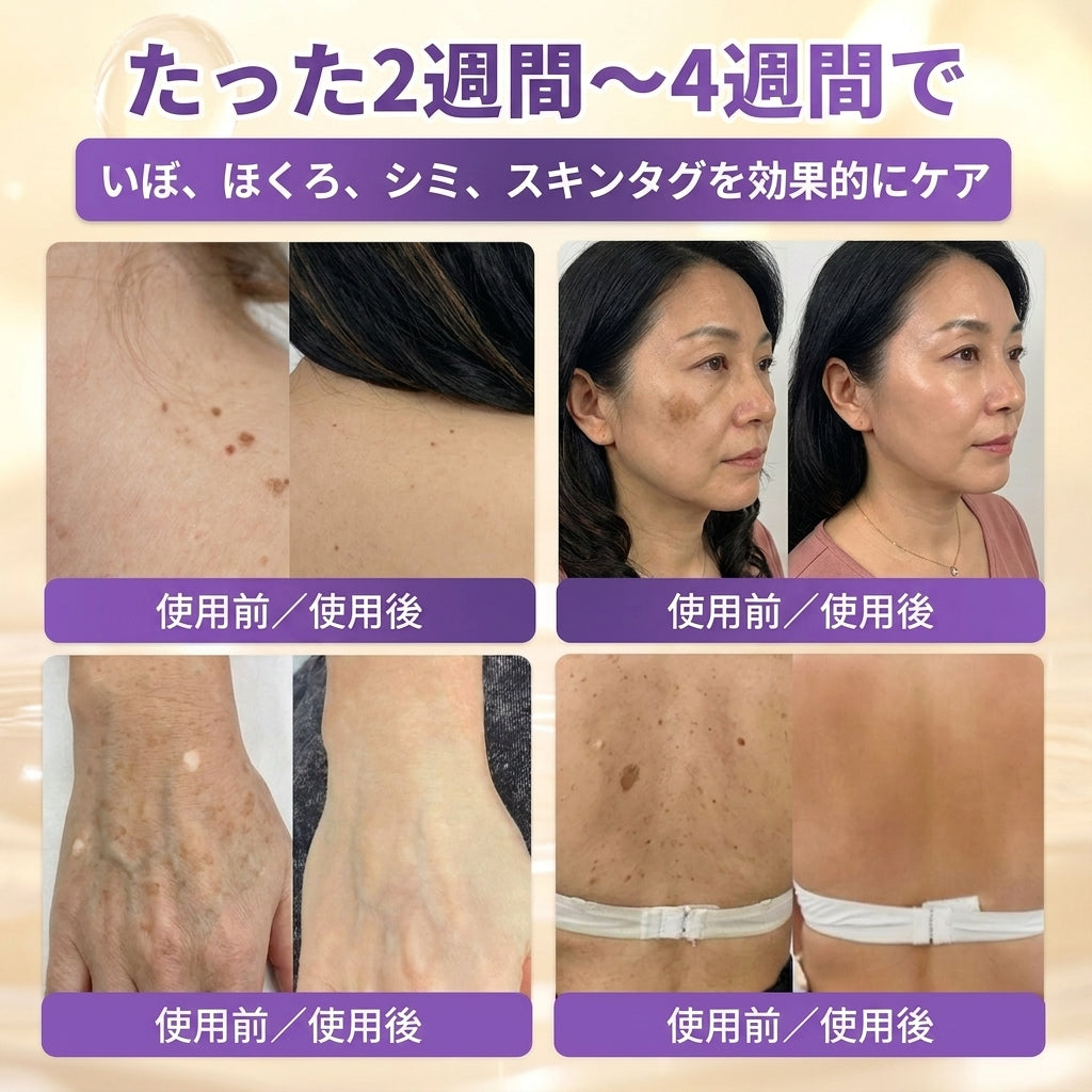 日本製・国内発送✨ 𝐆𝐎𝐋𝐃𝐊𝐈𝐒𝐒® 𝐆𝐇𝐊-𝐂𝐮 & 𝐁𝐈𝐎𝐓𝐈𝐍 𝟏𝟎-𝐈𝐍-𝟏「ゴールドキッス ® GHK-Cu ＆ ビオチン 10-in-1」スキンリストアクリーム⚡贅沢な美容成分が 1 つに凝縮！！