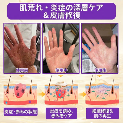 日本製・国内発送✨ 𝐆𝐎𝐋𝐃𝐊𝐈𝐒𝐒® 𝐆𝐇𝐊-𝐂𝐮 & 𝐁𝐈𝐎𝐓𝐈𝐍 𝟏𝟎-𝐈𝐍-𝟏「ゴールドキッス ® GHK-Cu ＆ ビオチン 10-in-1」スキンリストアクリーム⚡贅沢な美容成分が 1 つに凝縮！！