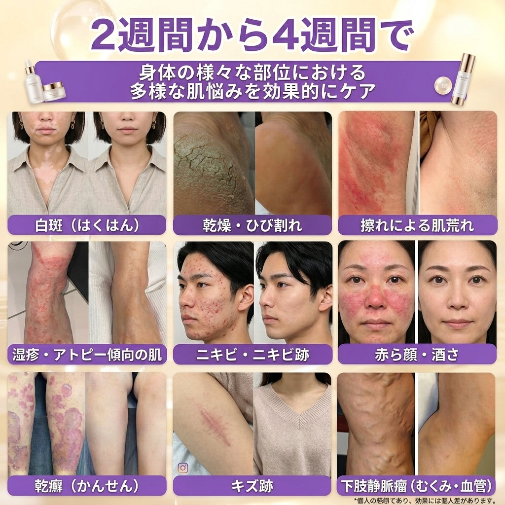 日本製・国内発送✨ 𝐆𝐎𝐋𝐃𝐊𝐈𝐒𝐒® 𝐆𝐇𝐊-𝐂𝐮 & 𝐁𝐈𝐎𝐓𝐈𝐍 𝟏𝟎-𝐈𝐍-𝟏「ゴールドキッス ® GHK-Cu ＆ ビオチン 10-in-1」スキンリストアクリーム⚡贅沢な美容成分が 1 つに凝縮！！