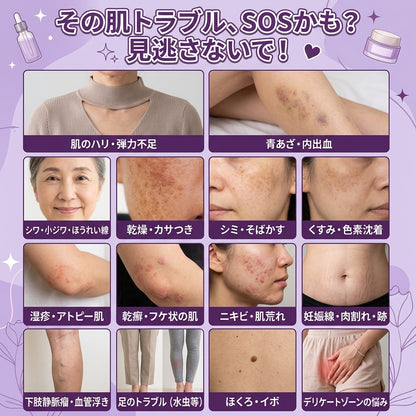 日本製・国内発送✨ 𝐆𝐎𝐋𝐃𝐊𝐈𝐒𝐒® 𝐆𝐇𝐊-𝐂𝐮 & 𝐁𝐈𝐎𝐓𝐈𝐍 𝟏𝟎-𝐈𝐍-𝟏「ゴールドキッス ® GHK-Cu ＆ ビオチン 10-in-1」スキンリストアクリーム⚡贅沢な美容成分が 1 つに凝縮！！