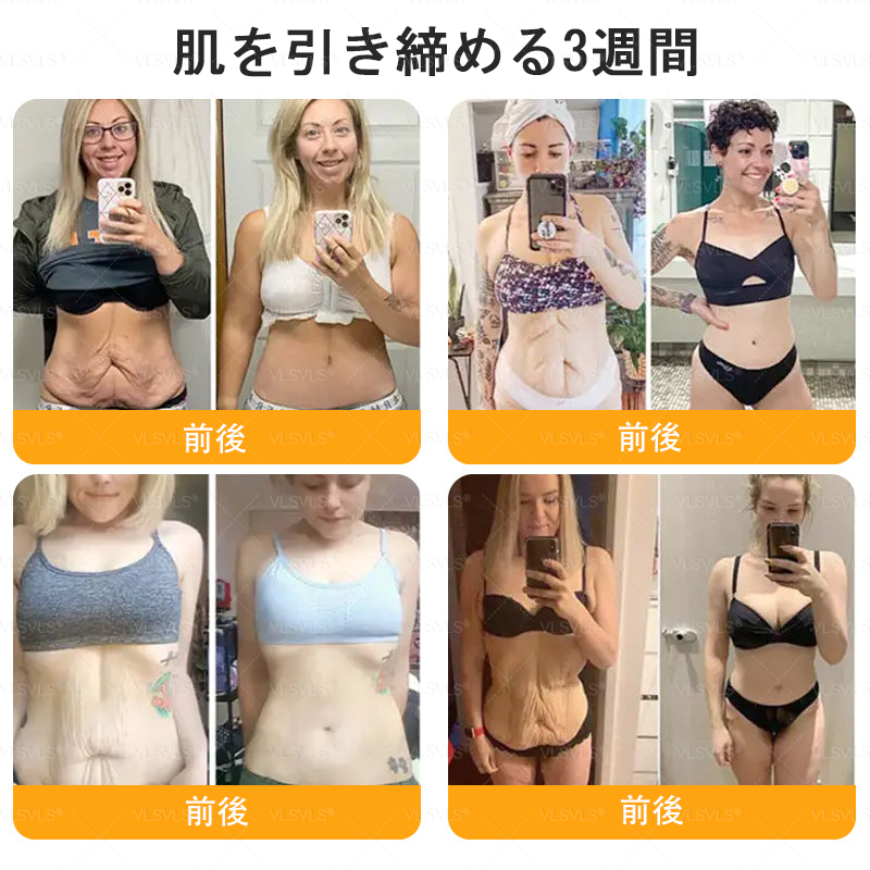 🇯🇵 日本製・日本から直送 🥇🥇  𝑽𝑳𝑺𝑽𝑳𝑺® ビーベノム コンプリヘンシブ クリーム  本日最終日｜80％OFF（肌のたるみ、乾燥による小ジワ、ハリ不足、バストラインやヒップラインの印象など、年齢とともに気になるボディスキンをトータルケア。うるおいとハリを与え、なめらかで引き締まった印象の肌へ導きます）