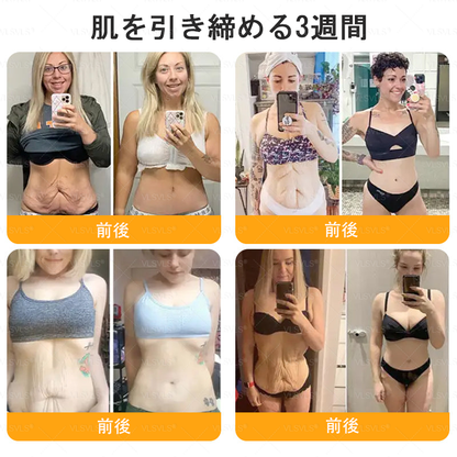 🇯🇵 日本製・日本から直送 🥇🥇  𝑽𝑳𝑺𝑽𝑳𝑺® ビーベノム コンプリヘンシブ クリーム  本日最終日｜80％OFF（肌のたるみ、乾燥による小ジワ、ハリ不足、バストラインやヒップラインの印象など、年齢とともに気になるボディスキンをトータルケア。うるおいとハリを与え、なめらかで引き締まった印象の肌へ導きます）