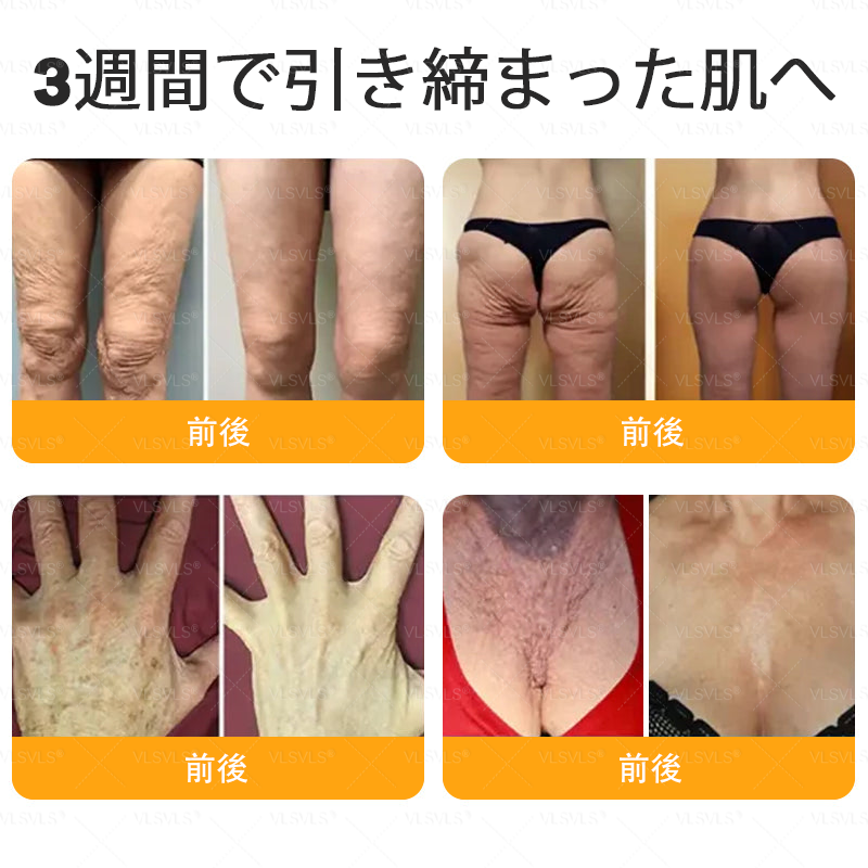 🎁残りわずか5箱！さらに50％OFFの追加割引をご用意しました！💪 健康的で引き締まった毎日へ。今すぐ始めましょう — 次のチャンスは来年までありません!（副本）