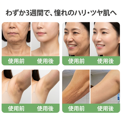 HISKIN® PDRN マルチペプチド ハリ・弾力コラーゲンボディオイル — エイジングケア、保湿ケア、ハリ・弾力ケア、なめらかな肌印象へ導くボディケア、肌トーンケア、ニキビ跡・乾燥による色ムラケア、肌表面の気になる部分のケア。