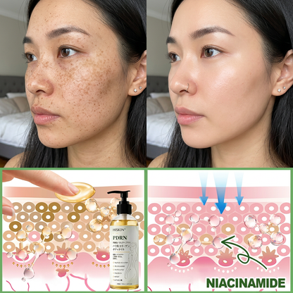 HISKIN® PDRN マルチペプチド ハリ・弾力コラーゲンボディオイル — エイジングケア、保湿ケア、ハリ・弾力ケア、なめらかな肌印象へ導くボディケア、肌トーンケア、ニキビ跡・乾燥による色ムラケア、肌表面の気になる部分のケア。